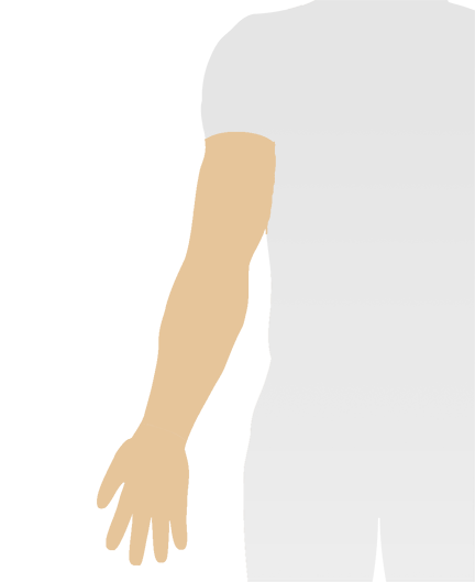 custom compression garment therapy arm sleeve glove